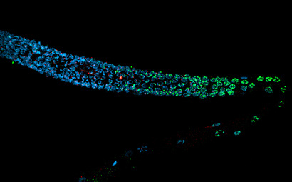 Epigenetic regulation of the cellular homeostasis amid transcription-blocking DNA damage during development and aging